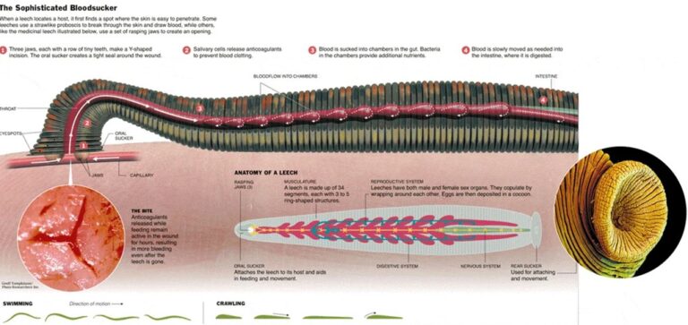Vysoký tlak a liečba pijavicami – hirudoterapia