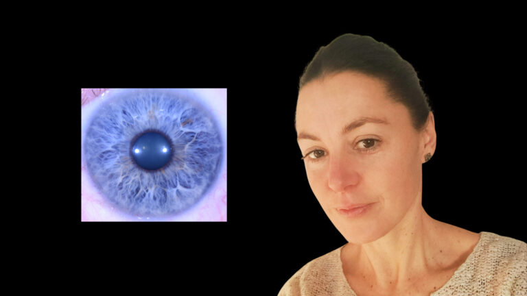 Irisdiagnostika a jej úloha pri hľadaní príčin chorôb